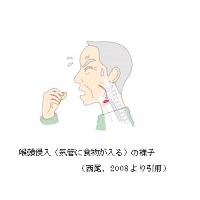 咽頭侵入（気管に植物が入る）の様子イラスト 西尾 2008より引用