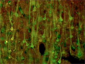 CD59 発現陽性の神経細胞の写真