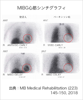 MIBG心筋シンチグラフィ（出典：MB Medical Rehabilitation (223) 145-150, 2018）