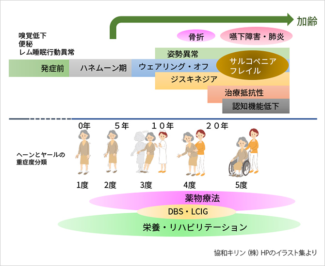 自動補充サービスを利用する